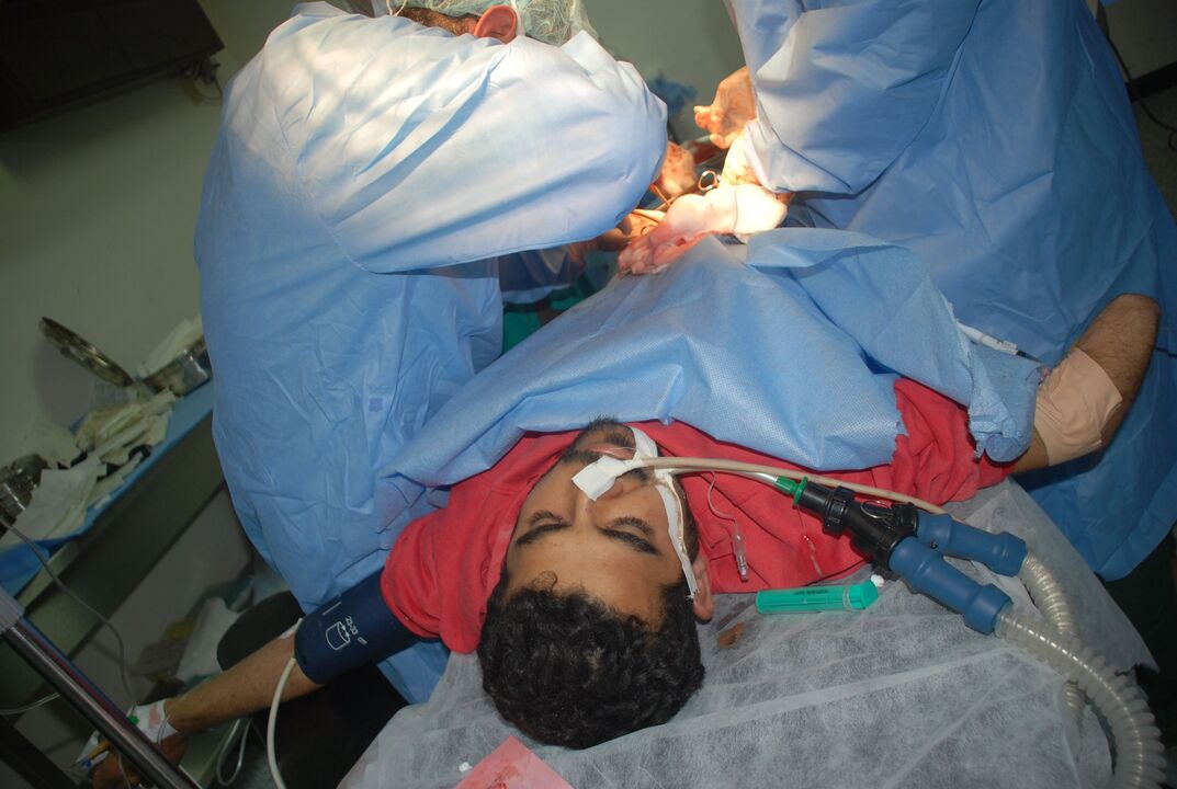 How penis enlargement surgery is performed